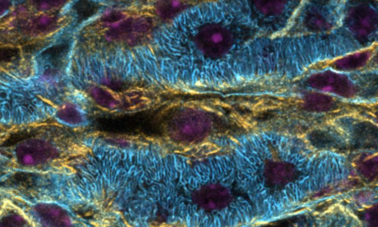 A multicolored image of a kidney section with purple circular areas surrounded by blue fibrous areas with yellow and black areas filling the spaces between.