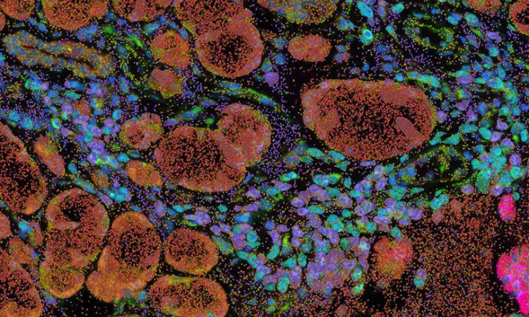 Fluorescent cells in orange, blue, purple, pink, and green on a black background.