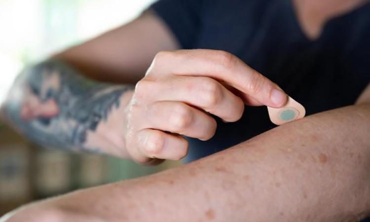 A micro needle patch is pressed to the skin