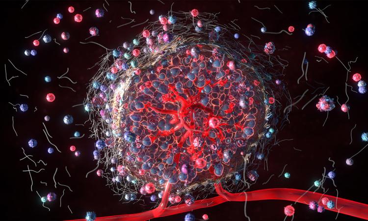 Illustration of the tumor microenvironment: Ankur Singh and Jean Koff want to understand what's happening at the biomolecular to create cancer disparities.