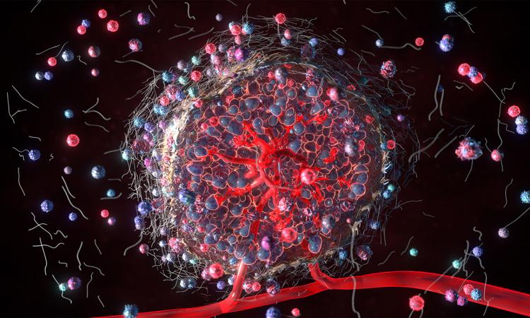 Illustration of the tumor microenvironment: Ankur Singh and Jean Koff want to understand what's happening at the biomolecular to create cancer disparities.  