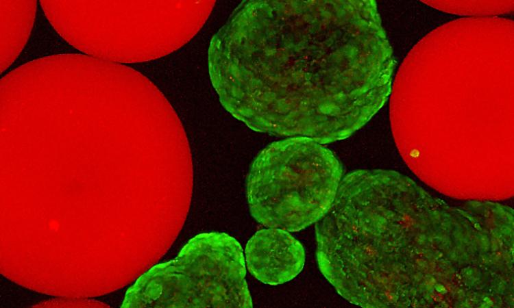 Green globules that are stained insulin-producing cells called islets and red globes that are microgels presenting a potent immune system protein called Fas ligand.