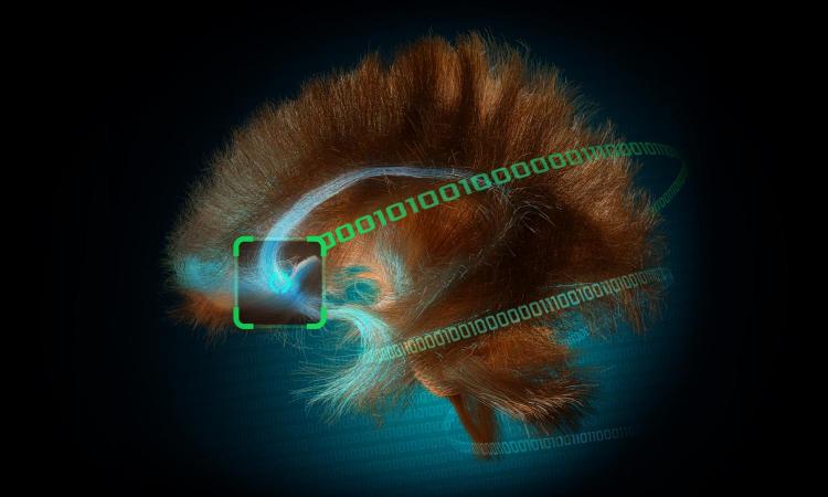 Copper-colored illustration of a hair-like mass shaped like a brain. The strands are the white matter structure of a patient brain. It's encircled by ones & zeros that connect to a bright spot in the frontal lobe with brightly lit pathways extending from that spot — the target pathways for a deep-brain stimulation therapy to treat severe depression. (Illustration: Mike Halerz, TeraPixel)