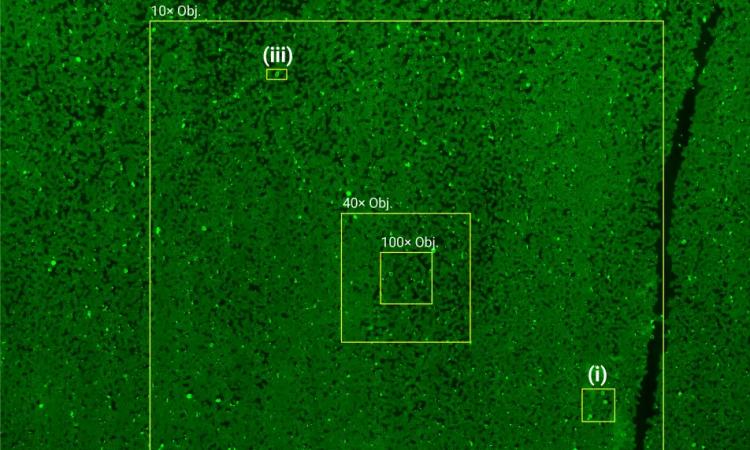 A flourescent green image of cells in a blood sample.