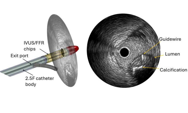 illustration of a heart catheter procedure