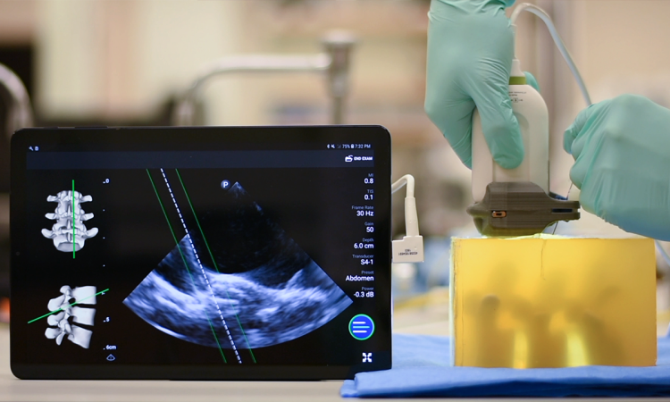 Demo of the low-cost needle guidance system, photo