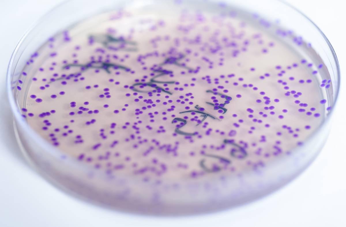 A sample from Mark Styczynski's lab.