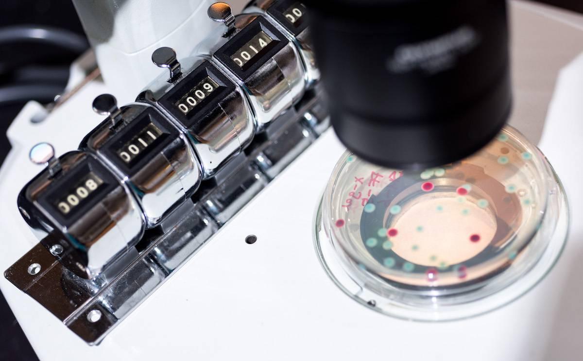 Samples being observed under a microscope.