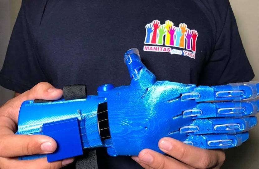 a 3D printed prosthetic hand