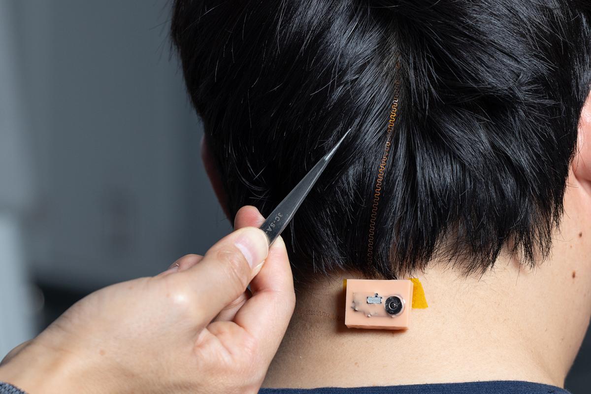 a hand with tweezers pointing out a brain device and wire on the back of a user's head