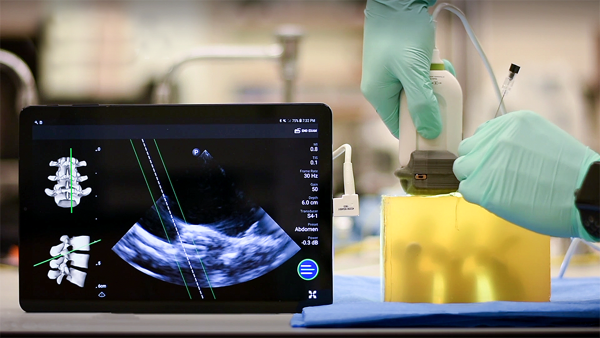 A simulation of the Ethos Medical lumbar puncture device