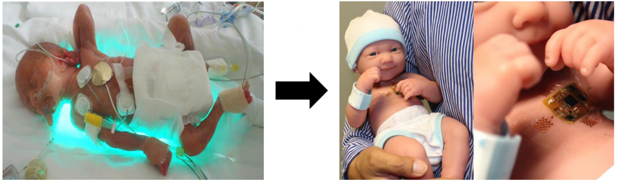 photo of infant wearing current monitoring systems used at hospitals today and photo of wireless monitoring device Gleason is testing